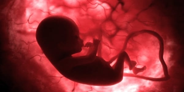 When Does Human Life Begin? With Dr. Maureen Condic